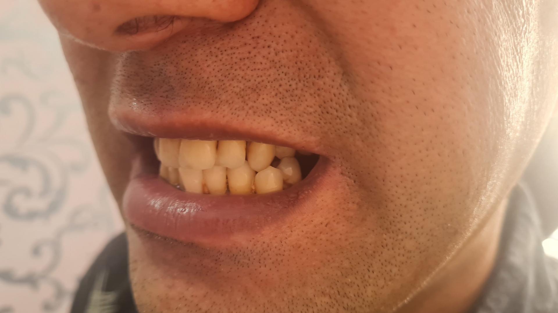 عکس دندانسازی کریمی