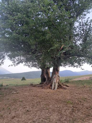 عکس گویتر