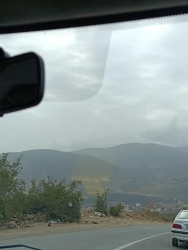 عکس گویتر