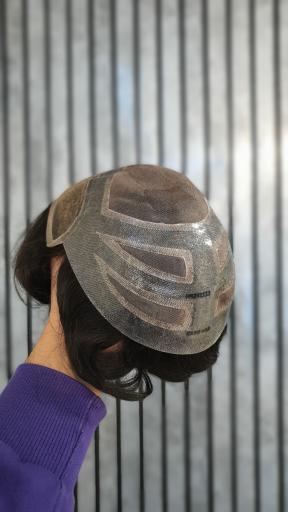 عکس ترمیم موی سهیل