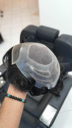 عکس ترمیم موی سهیل