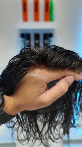 عکس ترمیم موی سهیل