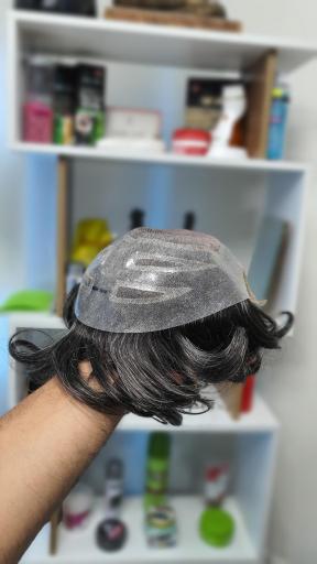 عکس ترمیم موی سهیل