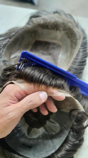 عکس ترمیم موی سهیل