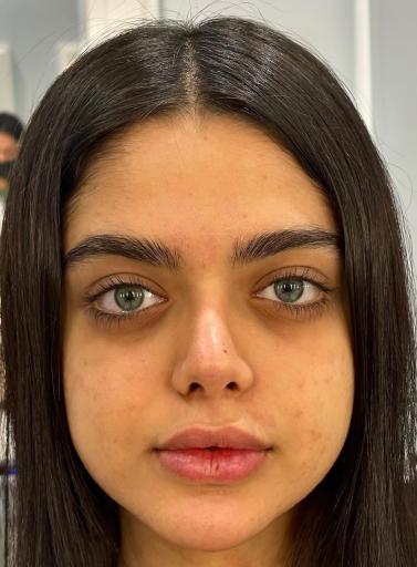 عکس سالن کراتین ساراوان