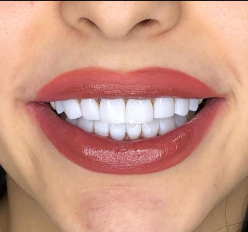 دندانسازی تجربی عارفخانی 