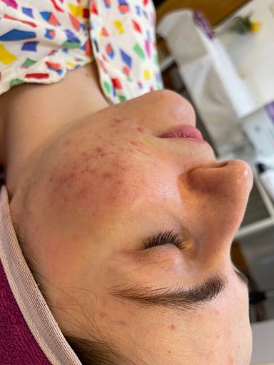 پاکسازی پوست النا مقیمی