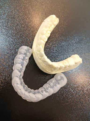 عکس دندان سازی تخصصی معصوم زاده