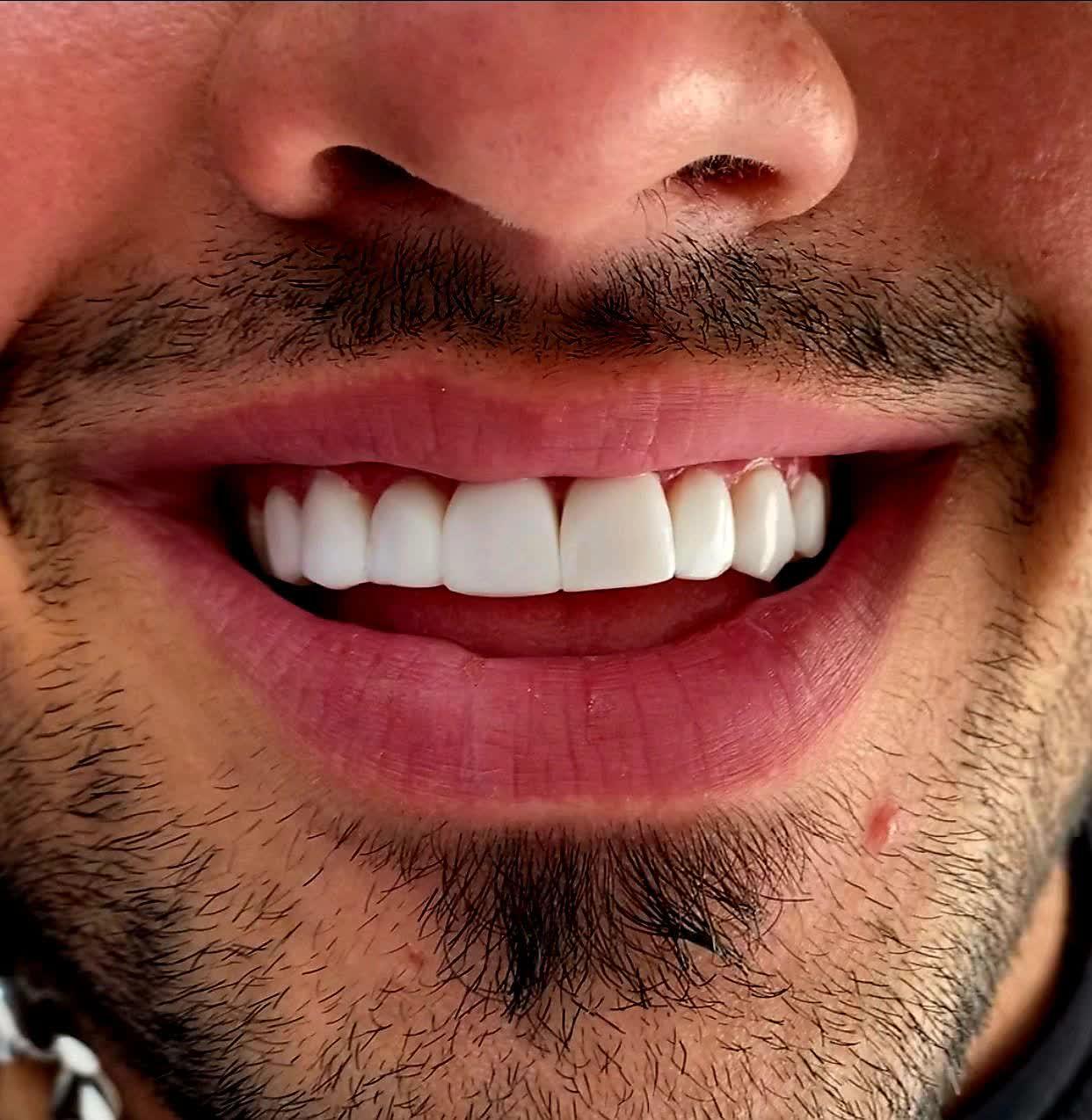 عکس دندان سازی تخصصی معصوم زاده