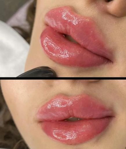 مطب زیبایی آیگل