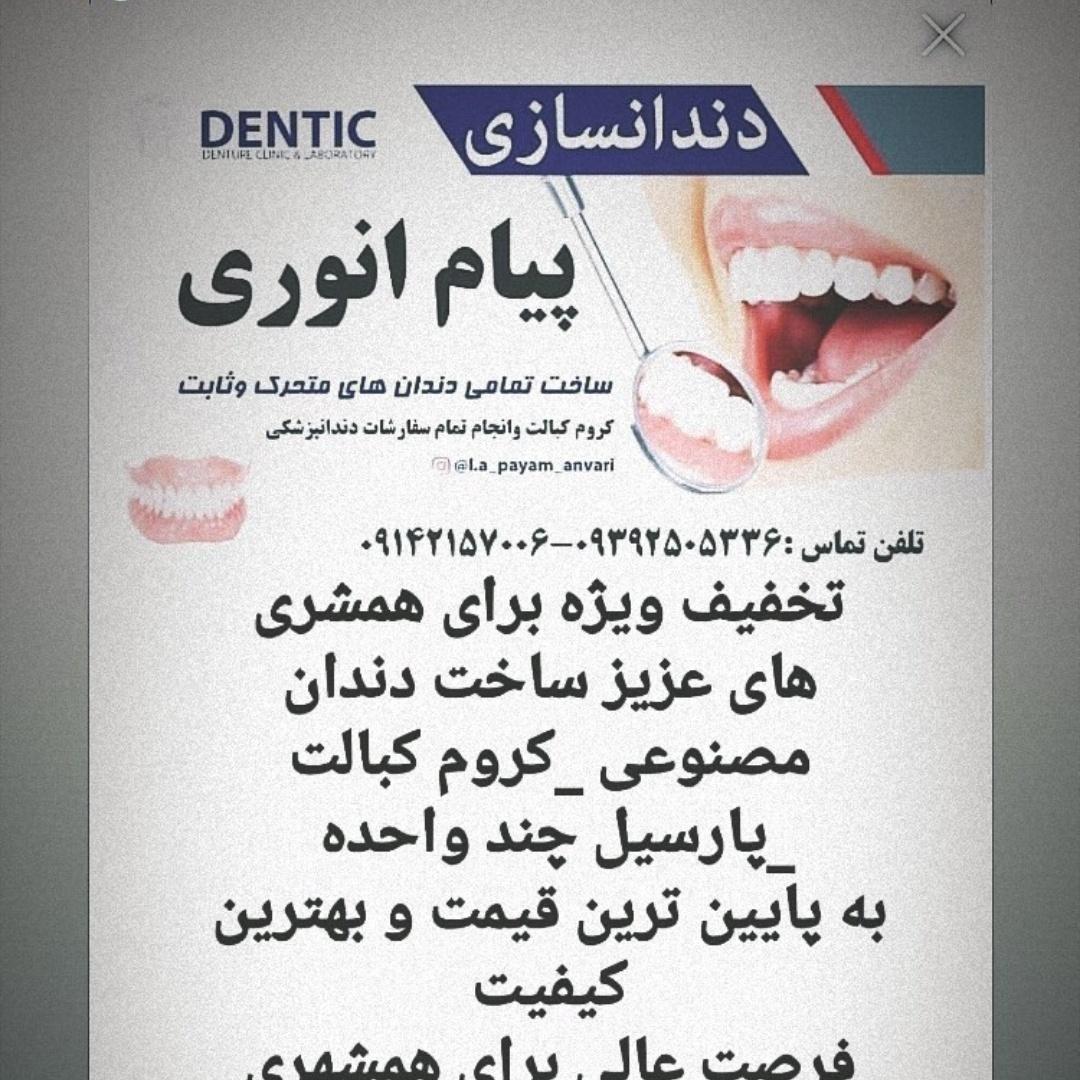عکس دندانسازی پیام انوری 