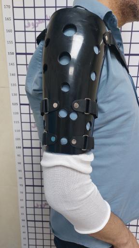 ارتوپدی فنی نوین