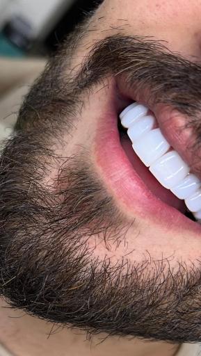 عکس دکتر اَمَن زاده متخصص دندان پزشکی