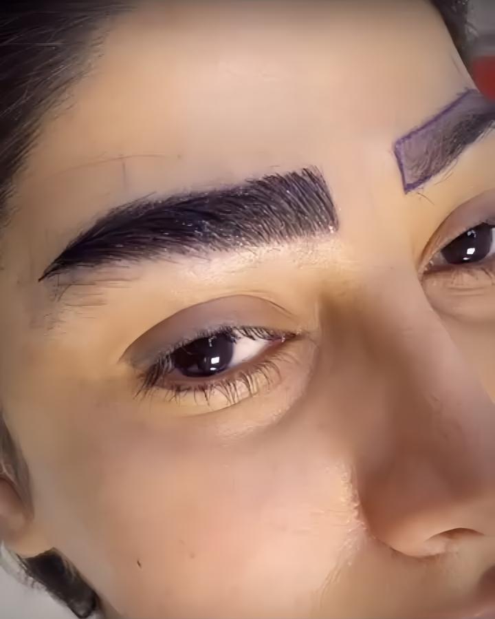 عکس کلینیک کاشت ابرو خميس 