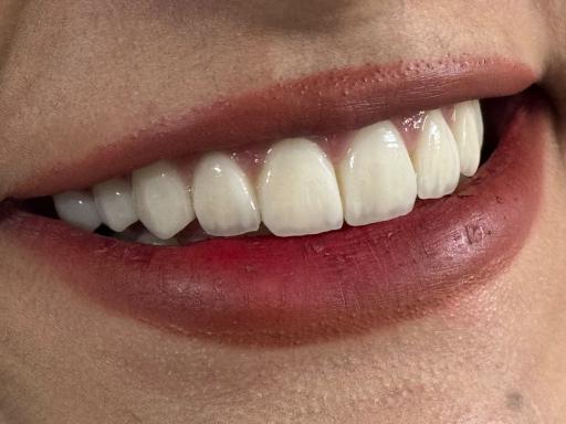 عکس مرکز ایمپلنت دکتر ذوقی
