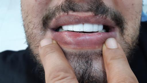 عکس مطب پروتزیست دندان آتشکار