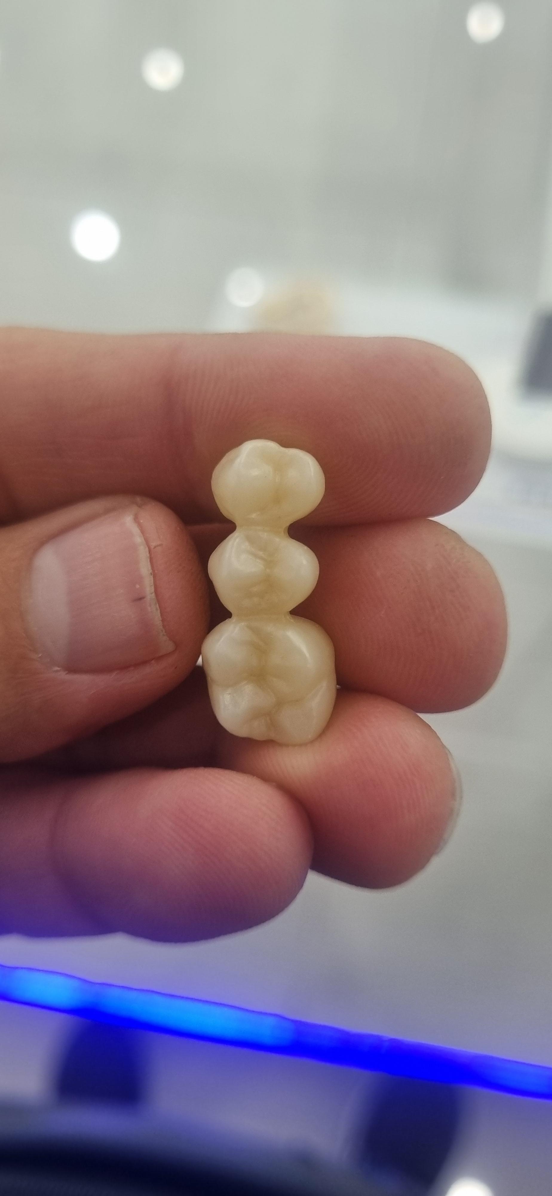 عکس دندانسازی پارسین دنتال جهانشاهی 