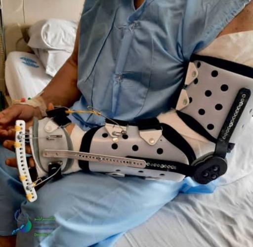 عکس کلینیک ارتوپدی فنی ایلیا