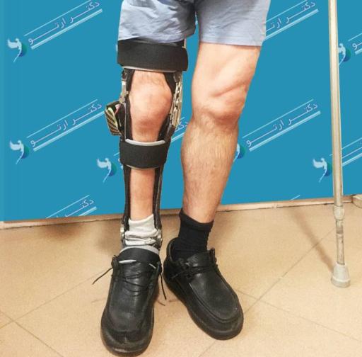 عکس کلینیک ارتوپدی فنی ایلیا