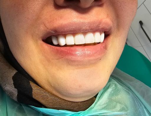 عکس مرکز ایمپلنت و دندانپزشکی زیبایی دکتر مهرداد افتحی