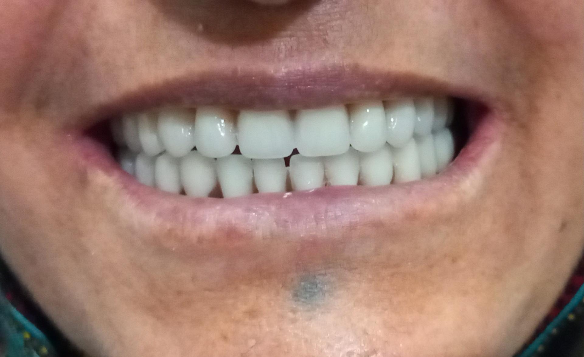 عکس پروتزیست دندان