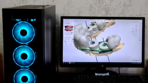 عکس رادیولوژی و‌ سی تی اسکن فک و صورت دکتر آرمان محققی