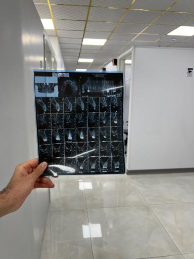 دکتر حسین فتوحی متخصص رادیولوژی فک و صورت