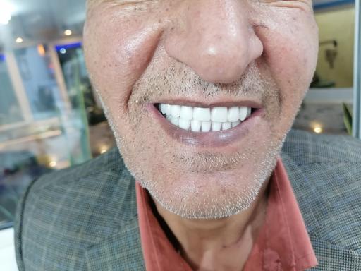 عکس دندان سازی سلام (صدرا)