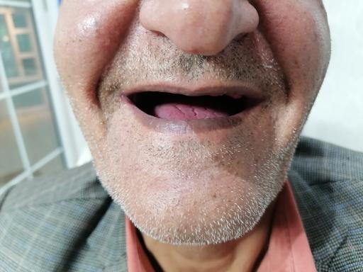 عکس دندان سازی سلام (صدرا)