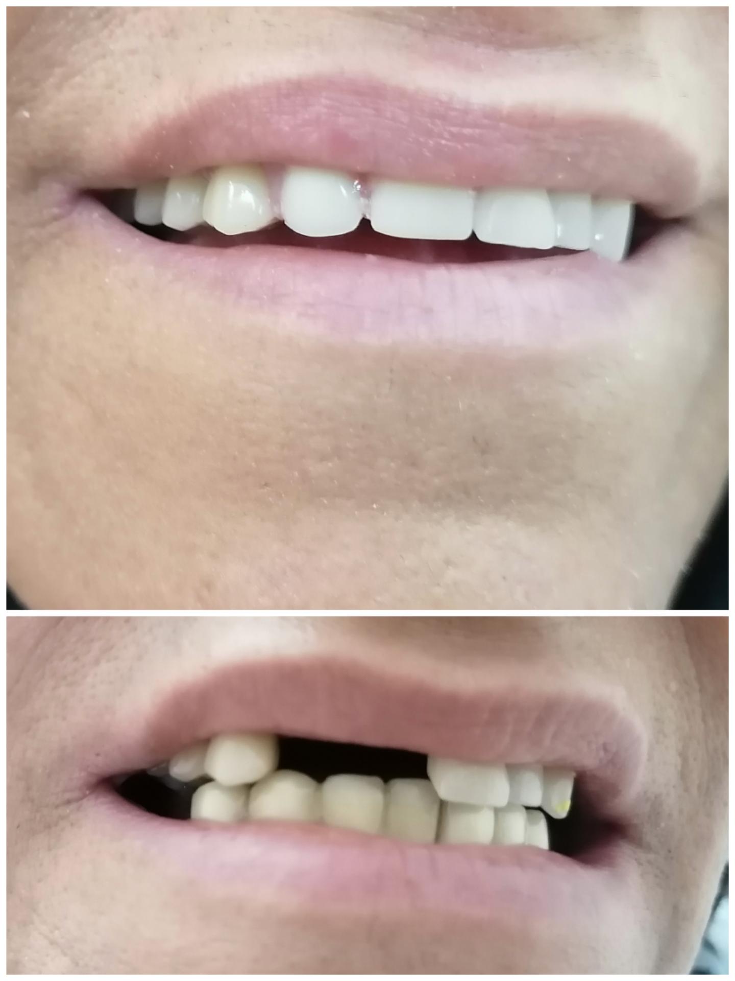 عکس دندان سازی سلام (صدرا)