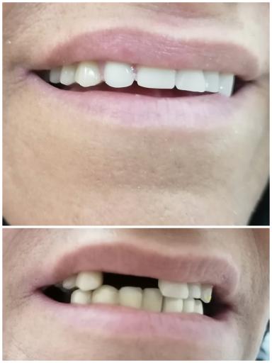 عکس دندان سازی سلام (صدرا)