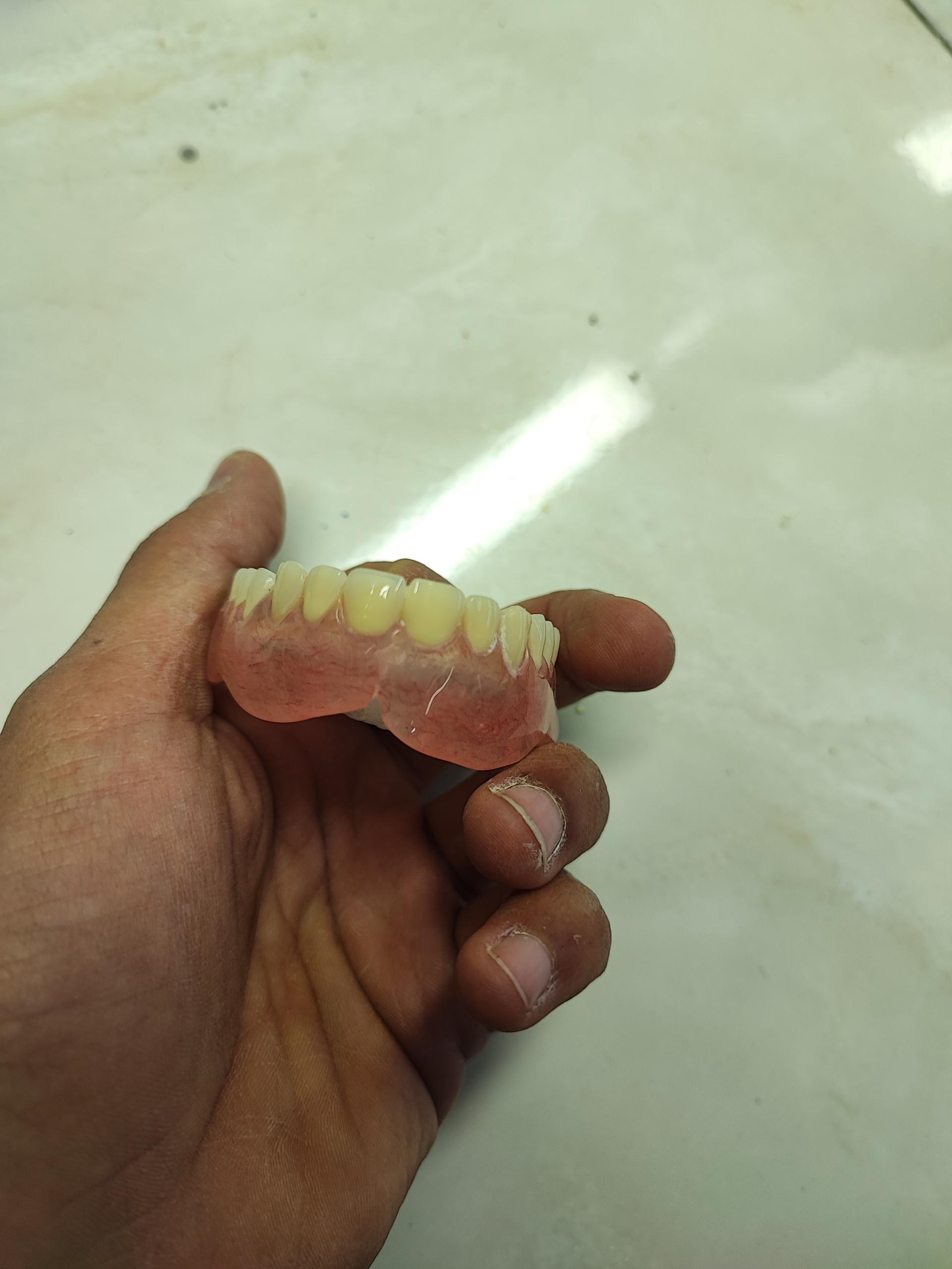 عکس دندانسازی دست دندون