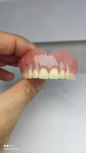 عکس دندانسازی دست دندون