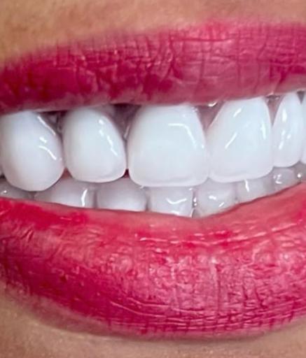عکس دندانسازی محمودی کیا