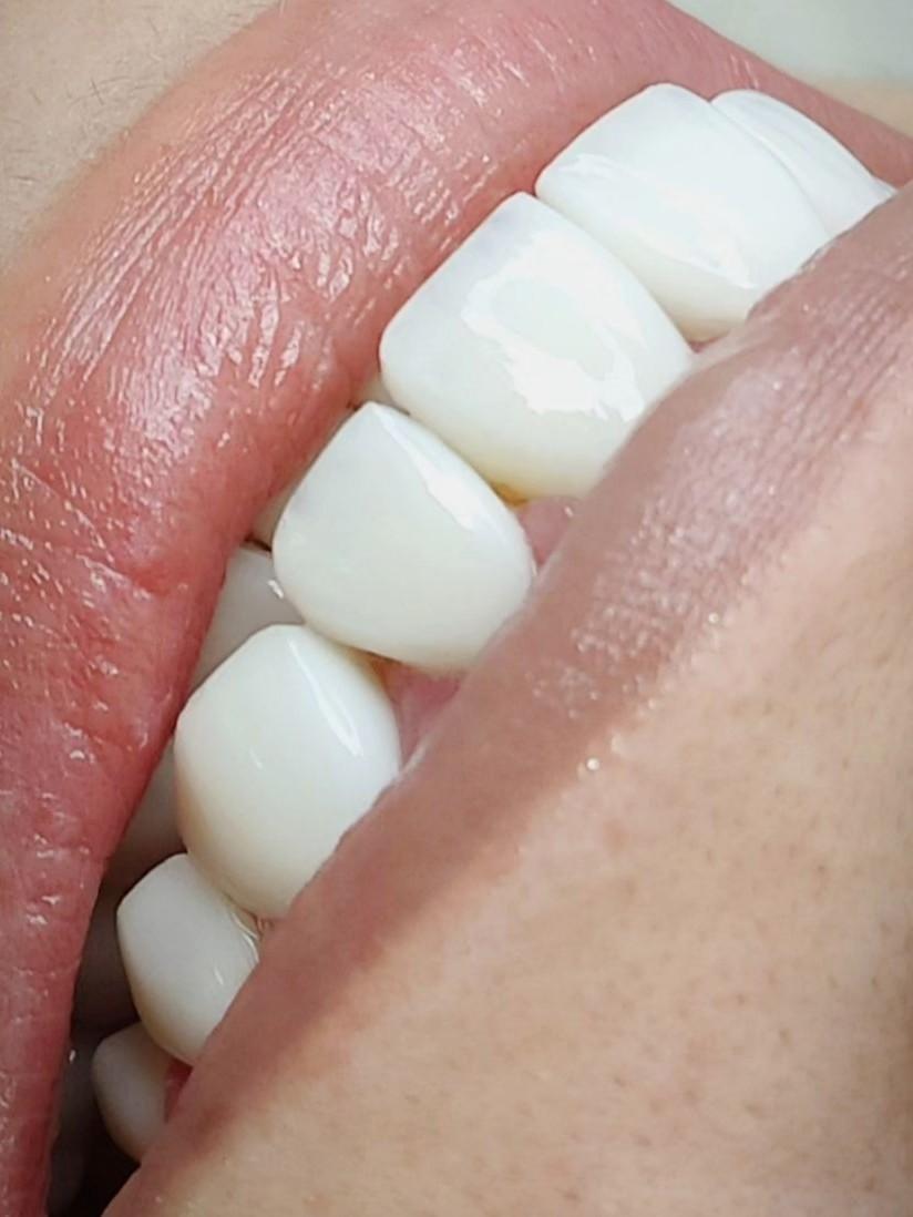 عکس دندانپزشکی دکتر یعقوب بزرگمنش