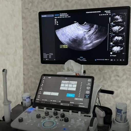 عکس سونوگرافی و رادیولوژی مهرآفرین 