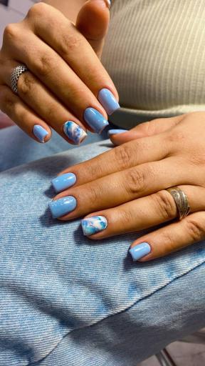 عکس کاشت و ترمیم ناخن میترا مهدویان