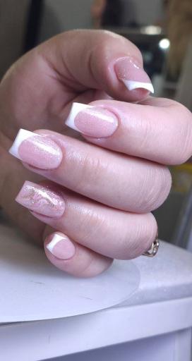 عکس کاشت و ترمیم ناخن میترا مهدویان