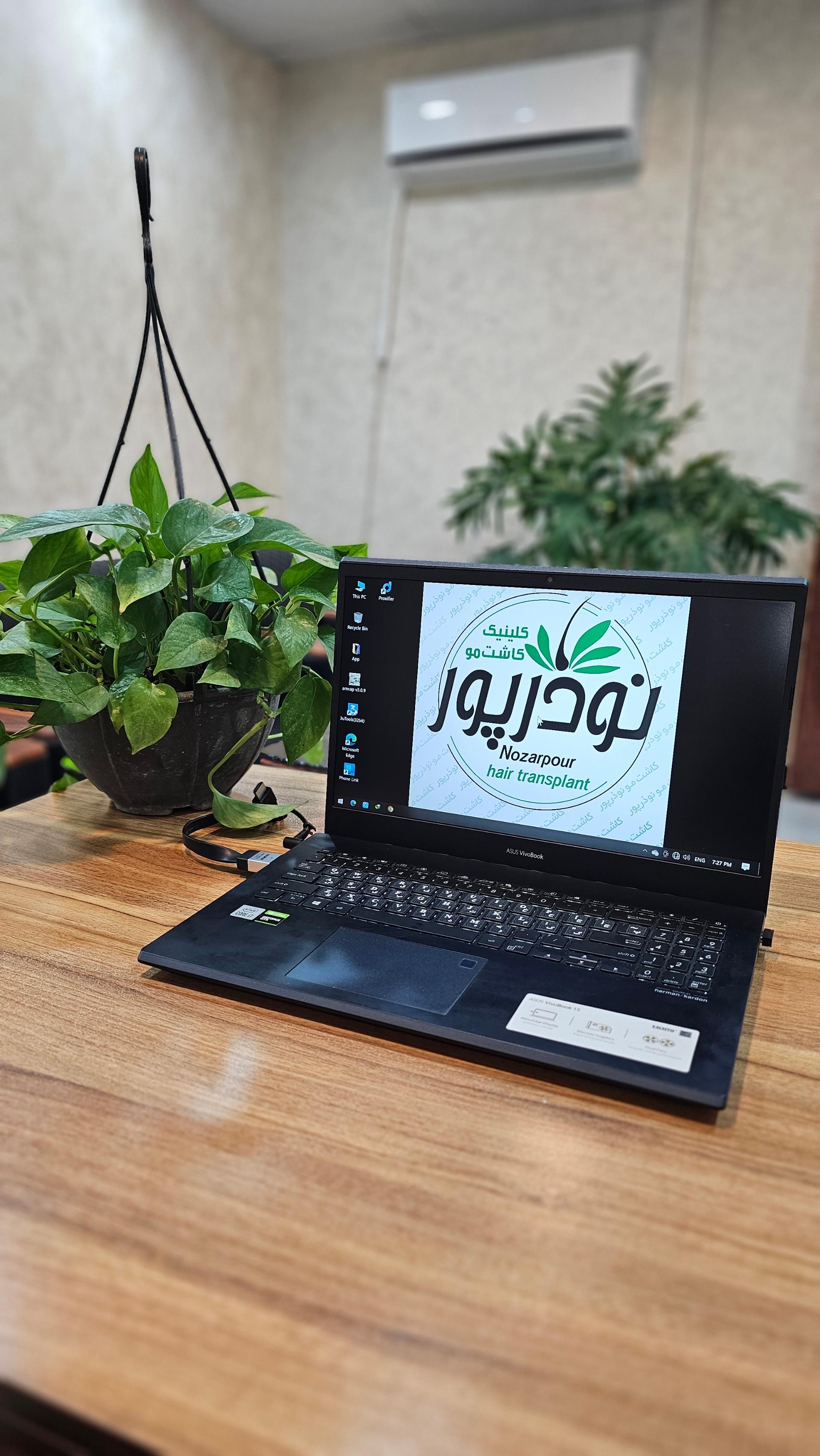 عکس کاشت مو نوذرپور