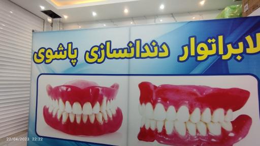 عکس دندانسازی دکتر پاشوی
