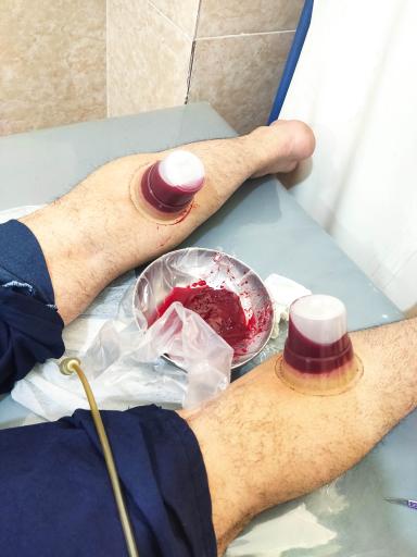 عکس طب سنتی اسلامی امیرالمؤمنین علی