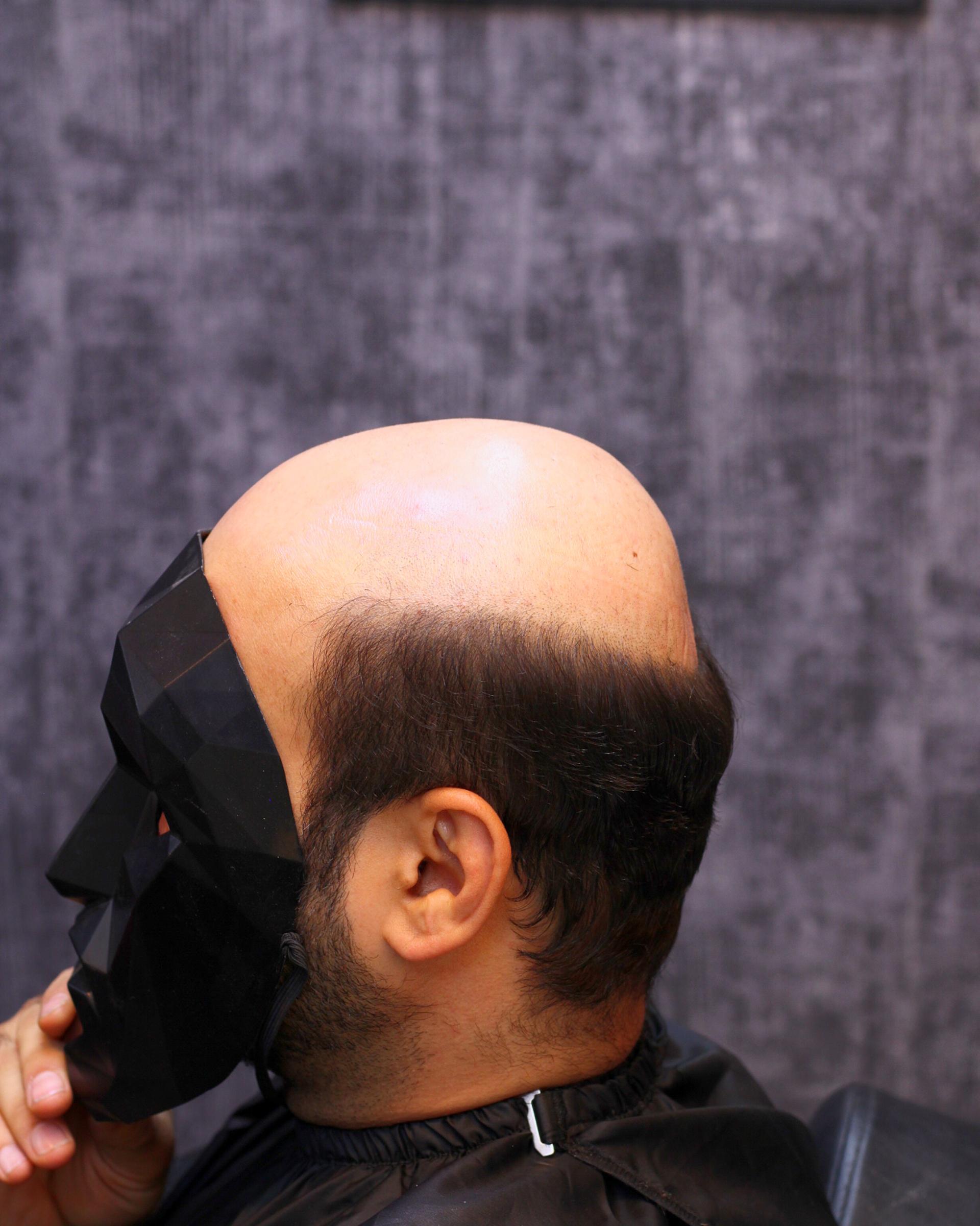 عکس آرایشگاه و ترمیم مو موسان