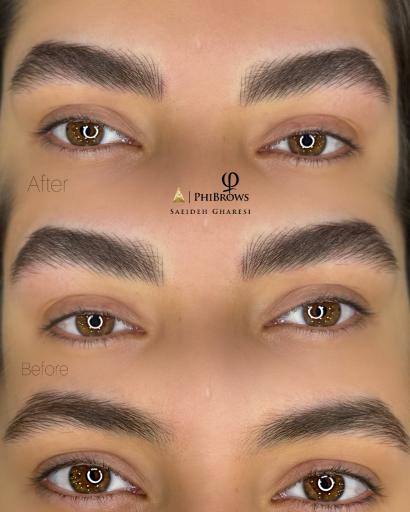 عکس مرکز فیبروز شیراز سعیده غارسی