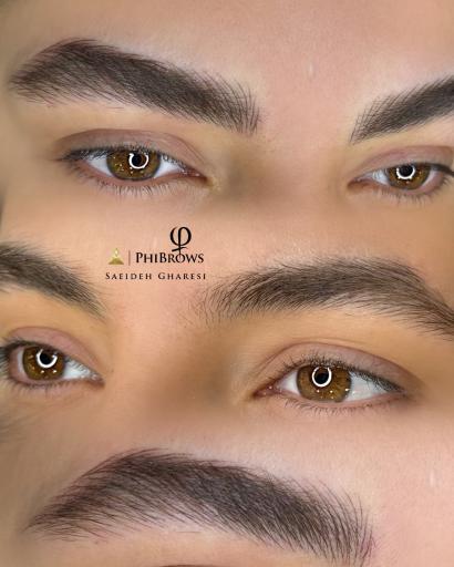 عکس مرکز فیبروز شیراز سعیده غارسی