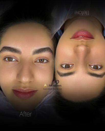 عکس مرکز فیبروز شیراز سعیده غارسی