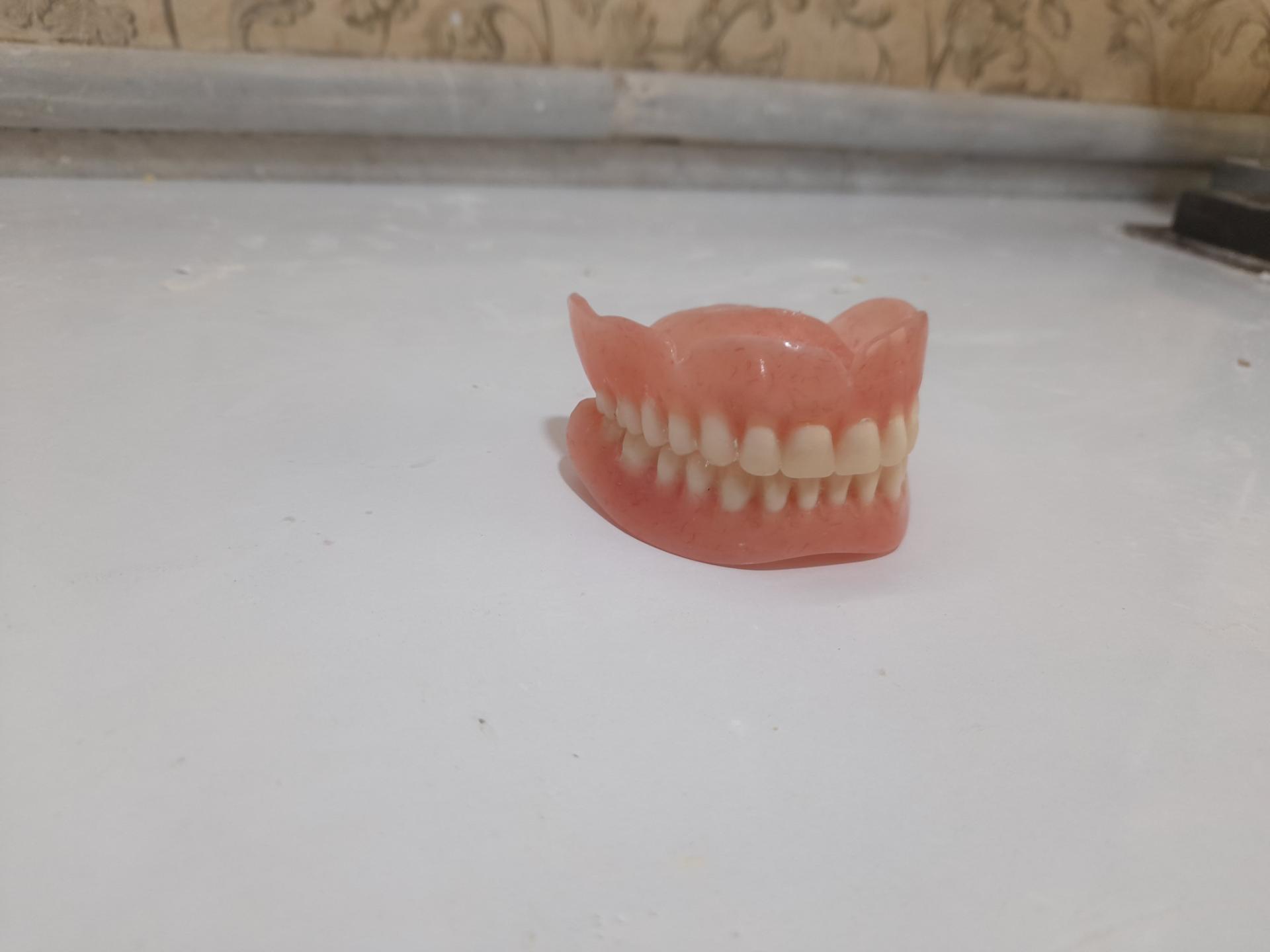 عکس دندانسازی لبخند