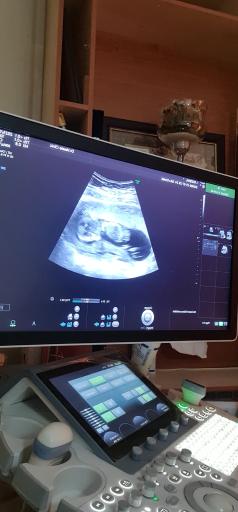 عکس سونوگرافی نرگس