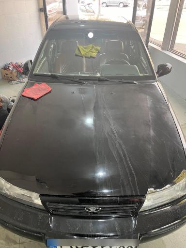 عکس دیتیلینگ آفتاب سوخته