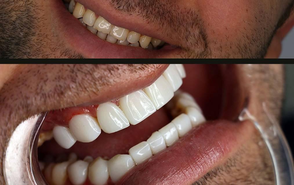 عکس دکتر مرادزاده متخصص دندان پزشکی