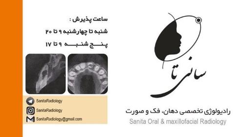 رادیولوژی تخصصی دهان، فک و صورت سانی تا